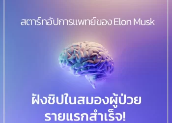 สตาร์ทอัปการแพทย์ของ Elon Musk ฝังชิปในสมองผู้ป่วยรายแรกสำเร็จ!